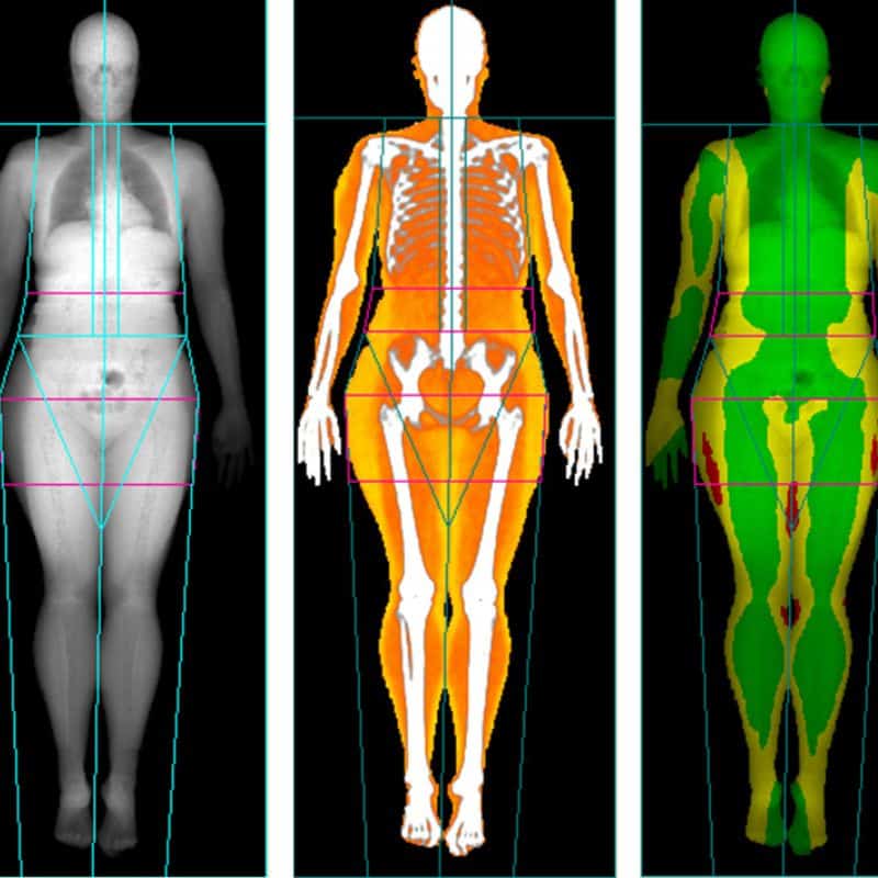 Estudio DEXA composición corporal para comprar en distintas comunidades. Estudio de masa ósea, medición de densidad ósea, alta precisión.