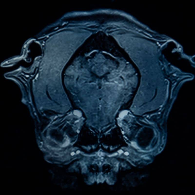 Resonancia magnética de abdomen en Sevilla, al mejor precio.