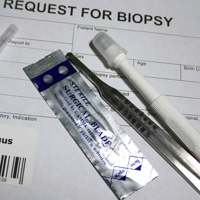 Biopsia en Grupo VIVO, al mejor precio.