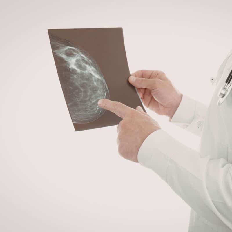 Mamografía para pacientes privados, en VIVO.