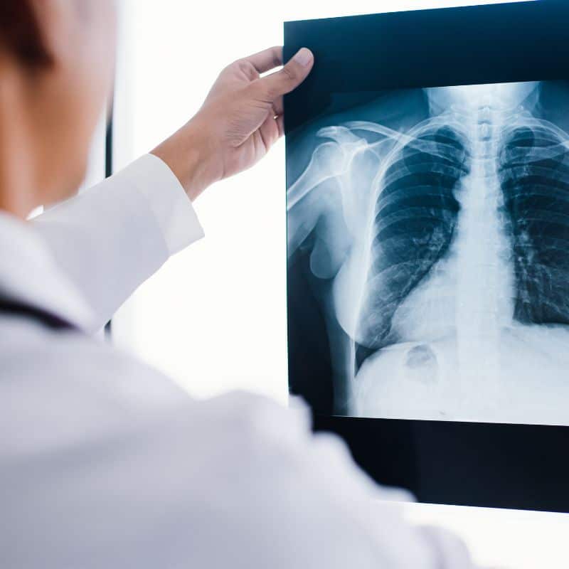 Comprar radiografía de abdomen, en Grupo VIVO.