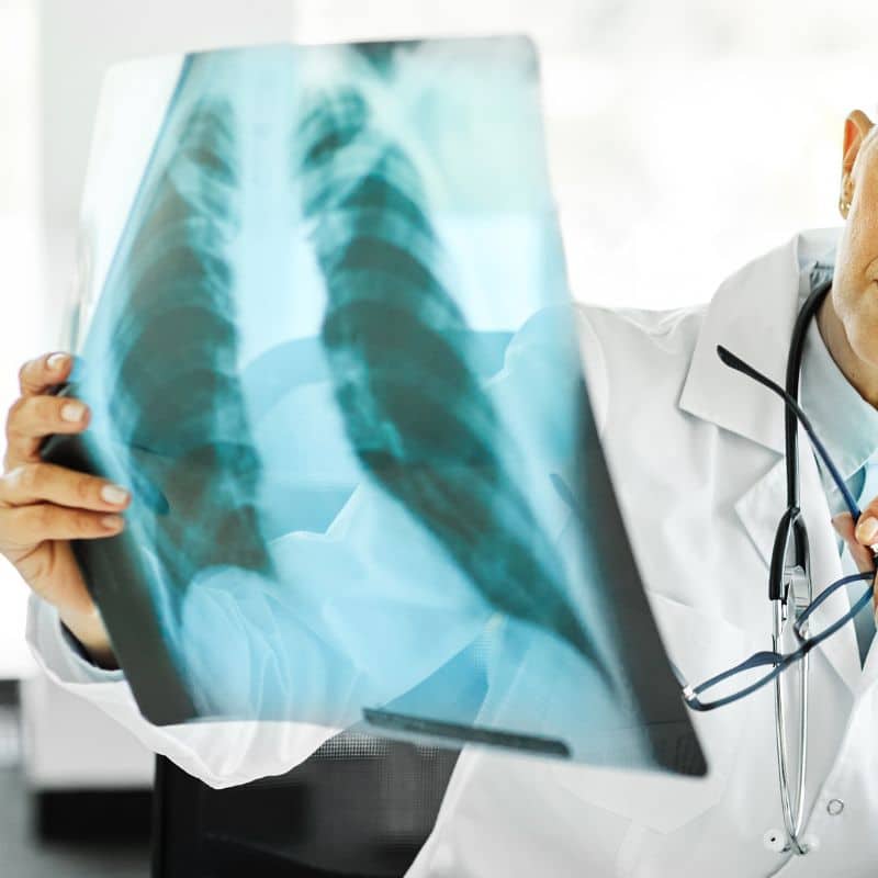 Comprar radiografía de columna, en Grupo VIVO.