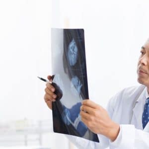 Radiografía de extremidades, en Grupo VIVO, al mejor precio.