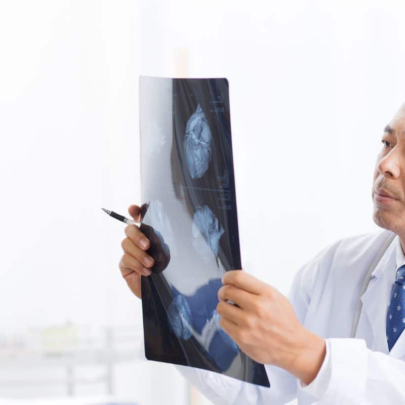 Radiografía de extremidades, en Grupo VIVO, al mejor precio.