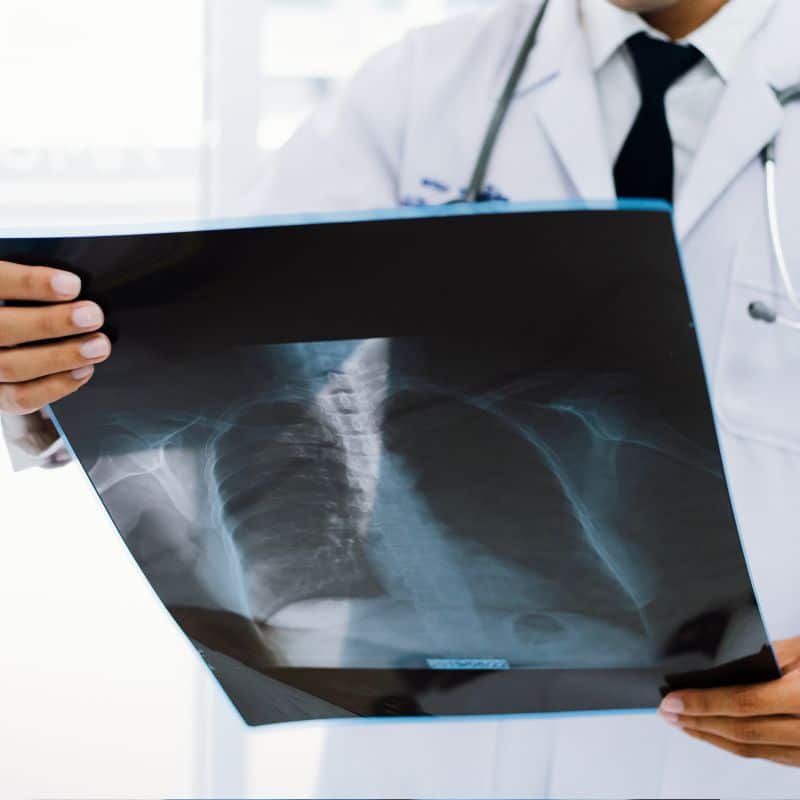 Comprar radiografía de tórax en Grupo VIVO, al mejor precio.