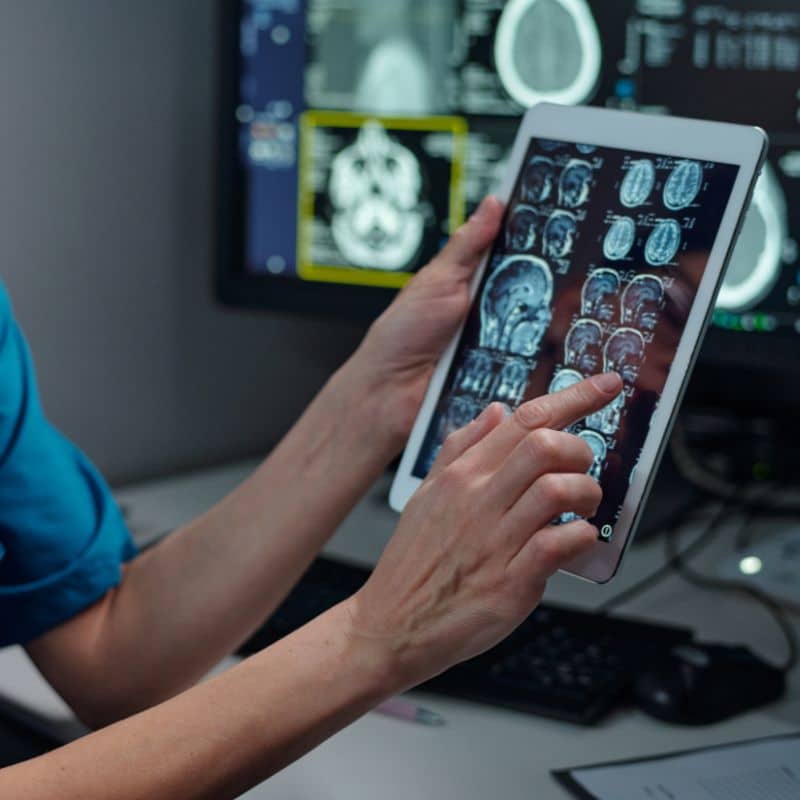 Resonancia Magnética de Cerebro