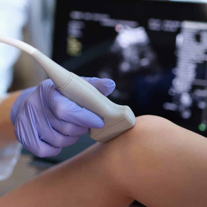 Comprar ecografía de rodilla, en Grupo VIVO.