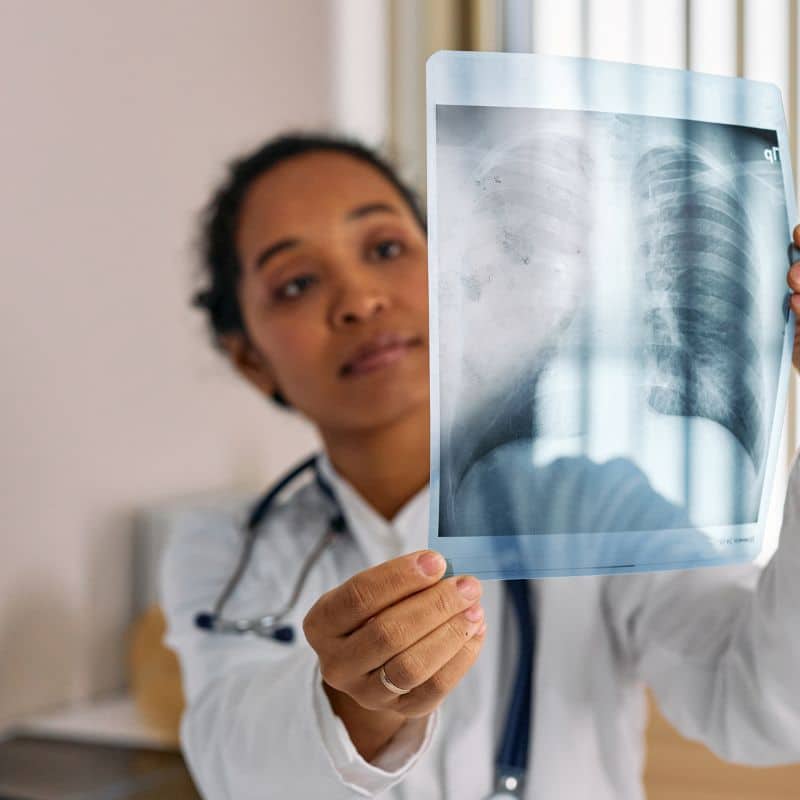 Radiografía con Asisa y VIVO.