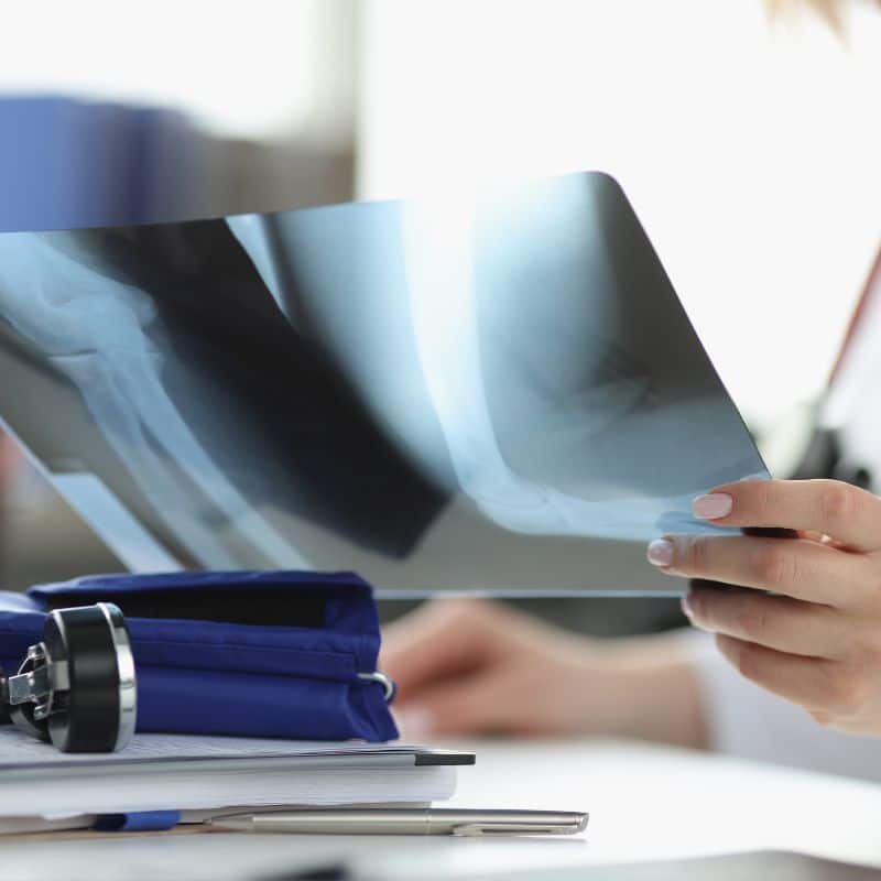 Resonancia de extremidades (no articular), al mejor precio en Grupo VIVO.