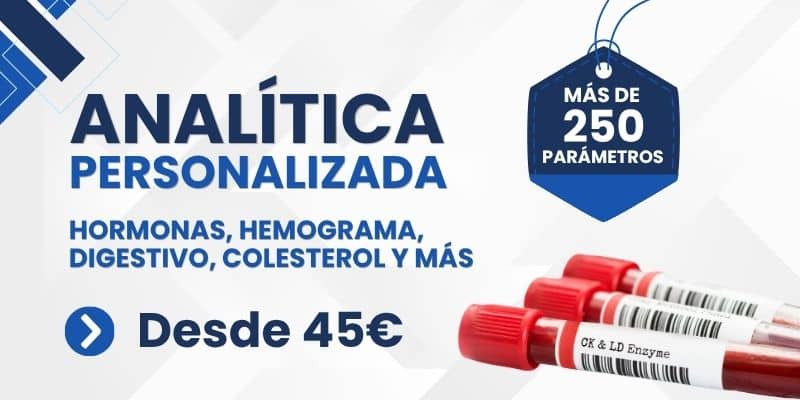 Analítica personalizada, en GRUPO VIVO.