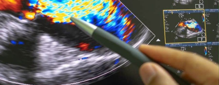 Ecografía testicular doppler en Grupo VIVO.
