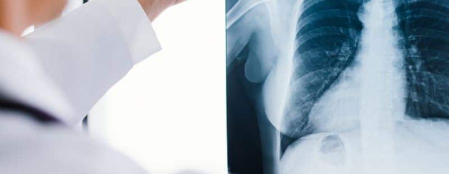 Comprar radiografía de abdomen, en Grupo VIVO.