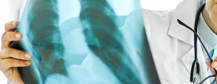 Comprar radiografía de columna, en Grupo VIVO.