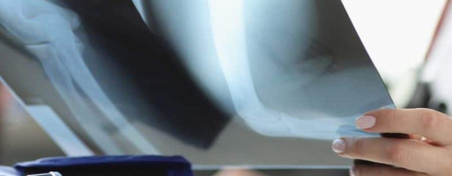 Resonancia de extremidades (no articular), al mejor precio en Grupo VIVO.