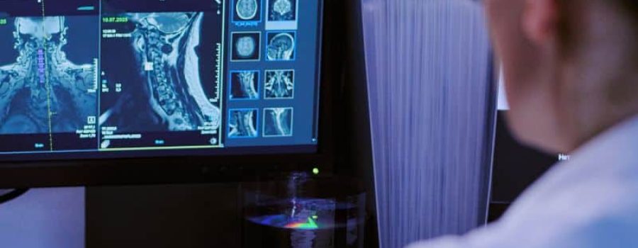Comprar resonancia magnética cardiaca en Grupo VIVO, al mejor precio.