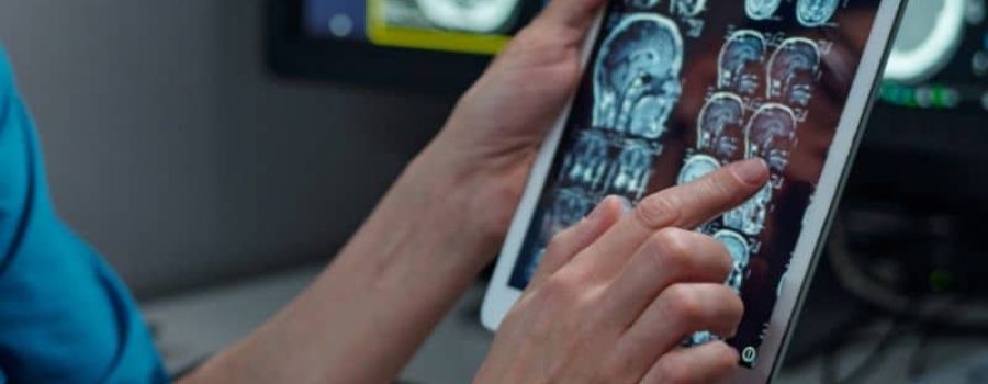 Compra tu resonancia magnética de cerebro o resonancia magnética de cabeza, en Grupo VIVO.